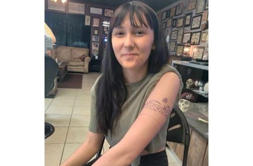 Saçını boyadı, amma sonu faciə ilə bitdi: 18 yaşlı qızın başında dəlik yarandı 