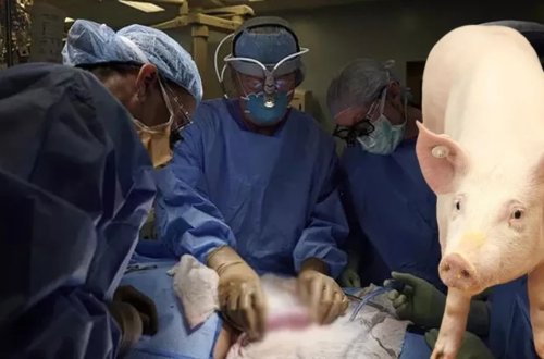 Dünyada ilk dəfə donuzdan insana ağciyər transplantasiyası həyata keçirilib
