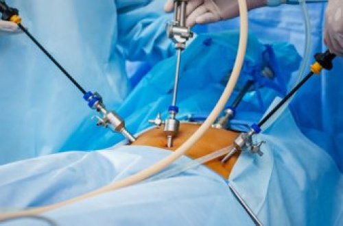 Mədəkiçiltmə əməliyyatı faciəyə səbəb oldu