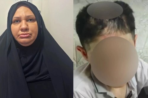 Xalası tərəfindən işgəncəyə məruz qalan yeniyetmə ilə bağlı YENİ XƏBƏR