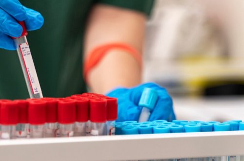 Narkomanların İİV-ə yeni yoluxma hadisələrinin sayında azalma müşahidə olunur