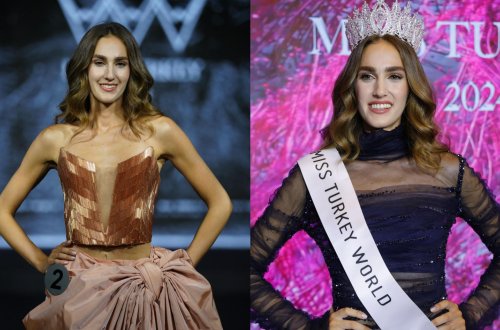 Türkiyə gözəli ABŞ-də həkimlik edəcək