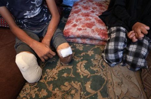 BMT komissarı: Oktyabrın 7-dən Qəzzada 4000 uşaq amputasiya edilib