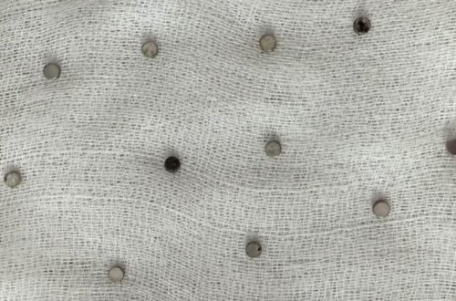 Türkiyədə 3 yaşlı uşaq 19 ədəd maqnit udub