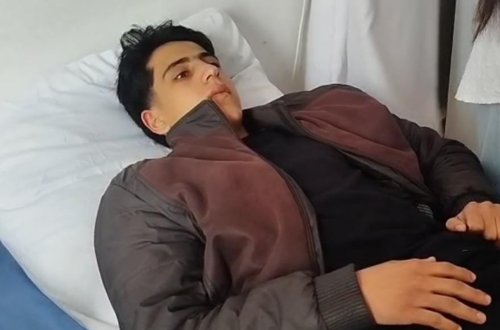 Şagird sinif yoldaşının atası tərəfindən döyüldü - FOTO