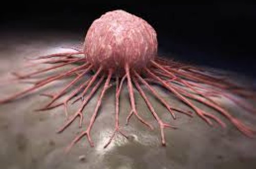 Xərçəngin 50 növü bir testlə aşkarlanacaq: Elm dünyasında sensasiya