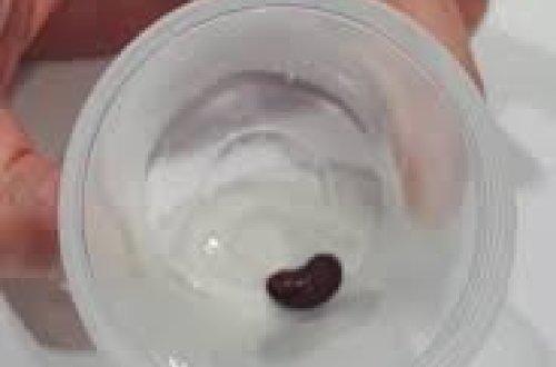 Bakıda körpənin ağciyərindən lobya toxumu çıxarılıb