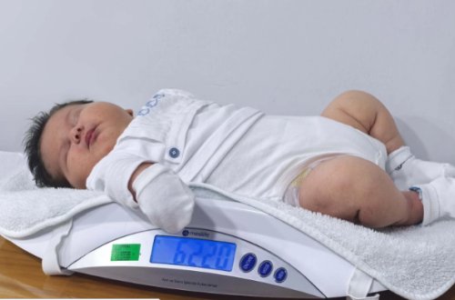 Türkiyədə 6 kiloluq uşaq doğuldu