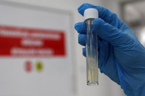 ÜST: 2024-cü ildə 1,2 milyondan çox insan vərəmdən öldü