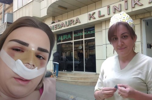 Ölüm saçan “MedAura” klinikası - Uğursuz əməliyyatlara səbəb olan Nigar Məhəmmədova iş başındadır? - ARAŞDIRMA