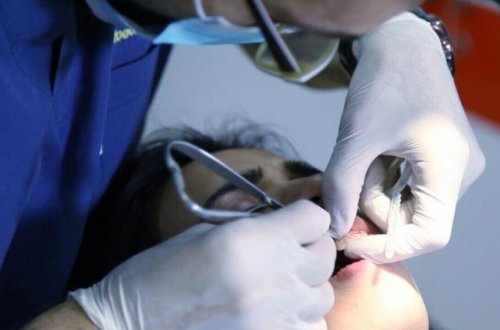 TƏBİB stomatoloqlara xəbərdarlıq etdi - Tədbir görüləcək