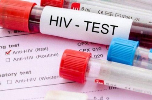 Azərbaycanda İİV-lə yaşayanların sayı açıqlanıb