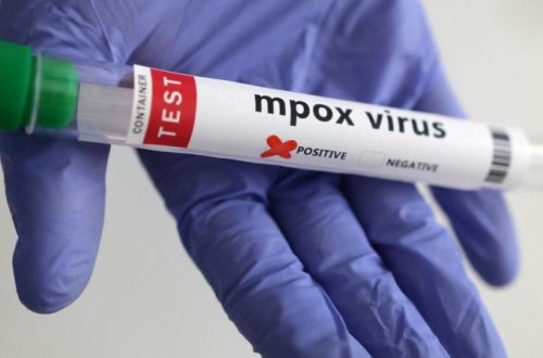 Meymun çiçəyi virusunun yeni ştammı müəyyən edilib