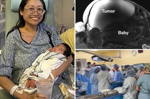 Möcüzəli doğuş: Nəhəng kistin altından çıxmış körpə 