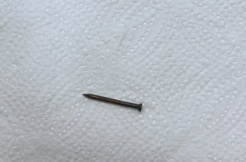 Bakıda azyaşlının mədəsindən mismar çıxarıldı - FOTO