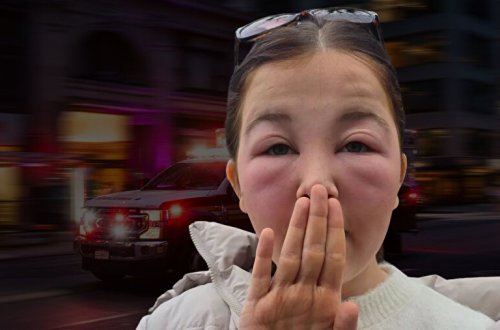 Makiyaj təmizləyicisindən istifadə etdi, təcili yardıma getdi