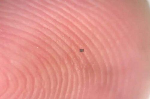 Dünyanın ən kiçik robotu insan bədəninin içində səyahət edəcək