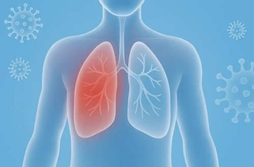 Pnevmoniyanın yaranma SƏBƏBLƏRİ