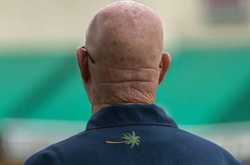 Tədqiqatçılar min illik bitkidə keçəlliyə çarə tapıblar