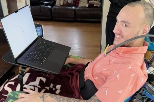 21 könüllü beyin çipi sınaqlarında iştirak edir