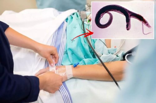 ÜST qlobal xəbərdarlıq edir: Genital parazit inkişaf edir və yeni ölkələrə yayıla bilər