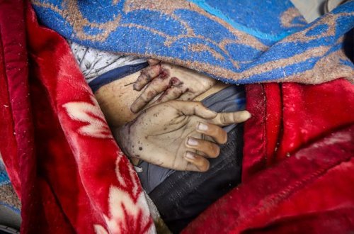 Qəzzada ölənlərin sayı 72 280 nəfərə çatıb