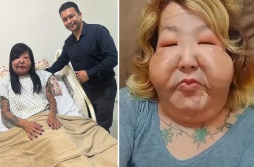 Üzünü gözəlləşdirmək istədi nəticə tərsinə oldu