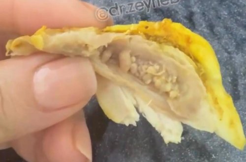 Toyuq ətində gizli TƏHLÜKƏ - Bu hissələri qətiyyən YEMƏYİN