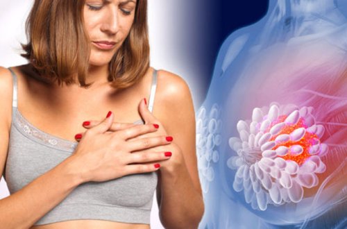 Süd vəzi xərçəngində yenilik: bir əməliyyatda kompleks müalicə imkanı