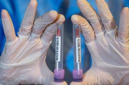 Hantavirus pandemiyaya çevriləcəkmi?