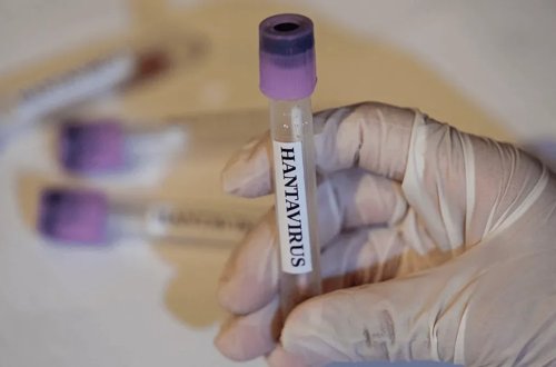 Fransada hantavirusa ilk yoluxma halı qeydə alınıb