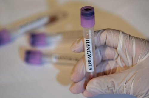 ÜST-dən hantavirus xəbərdarlığı: Yeni yoluxmalar arta bilər