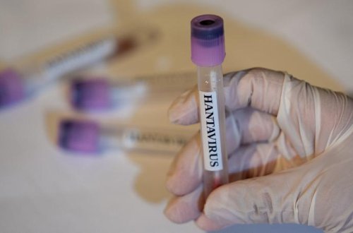 ÜST: Ölkələr yeni hantavirus hallarına hazır olmalıdırlar