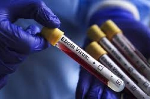 İtaliyada Ebola virusuna yoluxma faktı aşkarlanıb?