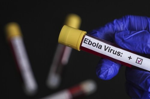 Konqo Demokratik Respublikasında 900-dən çox şübhəli Ebola hadisəsi qeydə alınıb