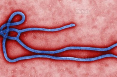 Beynəlxalq xəbərdarlıq: Ebola təhlükəsi böyüyür