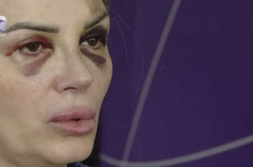 Bakıda mağazada döyülən qadın danışdı: “Demişdi ki, səni doğrayacağam” - VİDEO