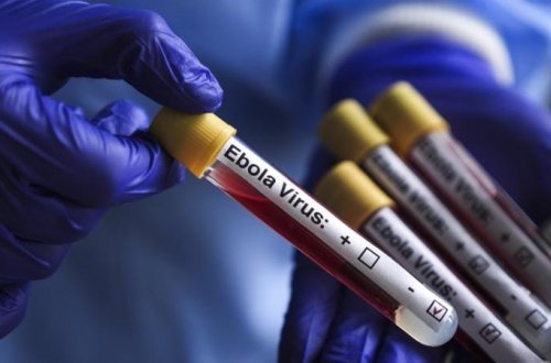 ÜST Uqandada Ebola epidemiyasının başa çatdığını təsdiqləyib