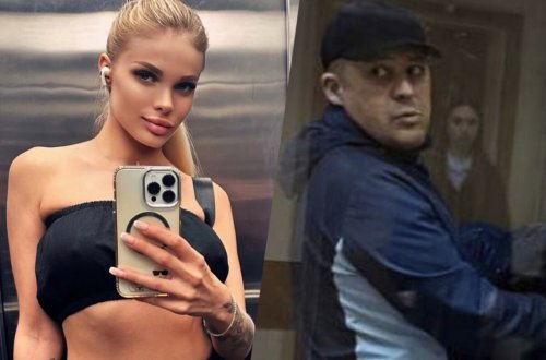 Rus model sevgilisi tərəfindən vəhşicəsinə döyüldü – Kəllə sümüyünün yarısını itirib - (Fotolar)