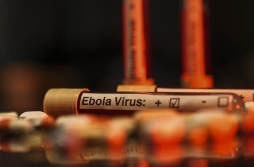 Konqo Demokratik Respublikasında Ebola hallarının sayı 7404-ə çatıb