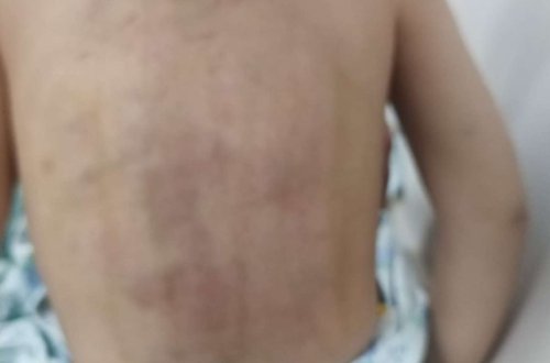 Döyülən 3 yaşlı uşağın anası valideynlikdən məhrum edilə bilər