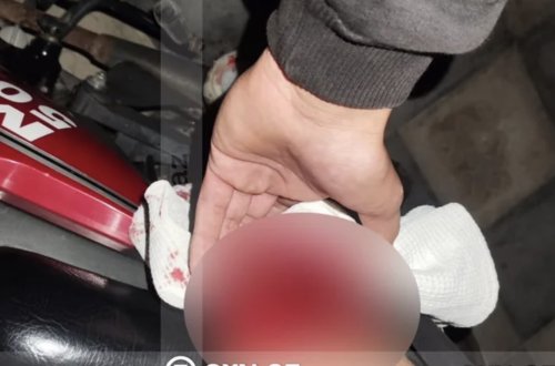 Bakıda VAZ-2107 11 yaşlı uşağı vurub qaçdı, polis yaxaladı - FOTO
