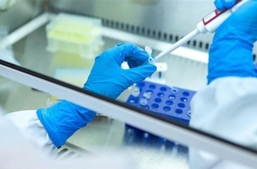 Rusiya Sibirdə taun laboratoriyası əməkdaşının ölümü ilə bağlı bəyanat yayıb