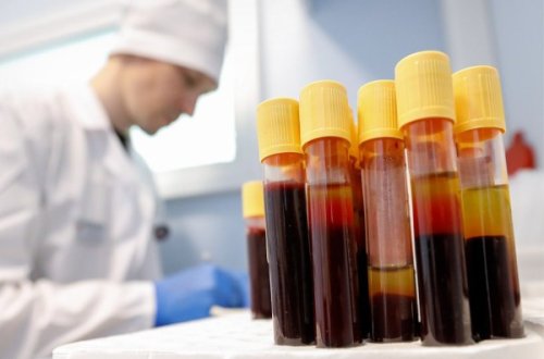 Rusiyanın 30 regionunda İİV ümumiləşdirilmiş epidemiya miqyasına qədər yayılıb