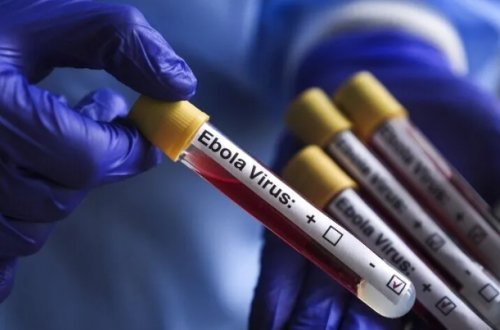 Konqoda Ebola faciəsi: Ölənlərin sayı 4 887-yə çatdı